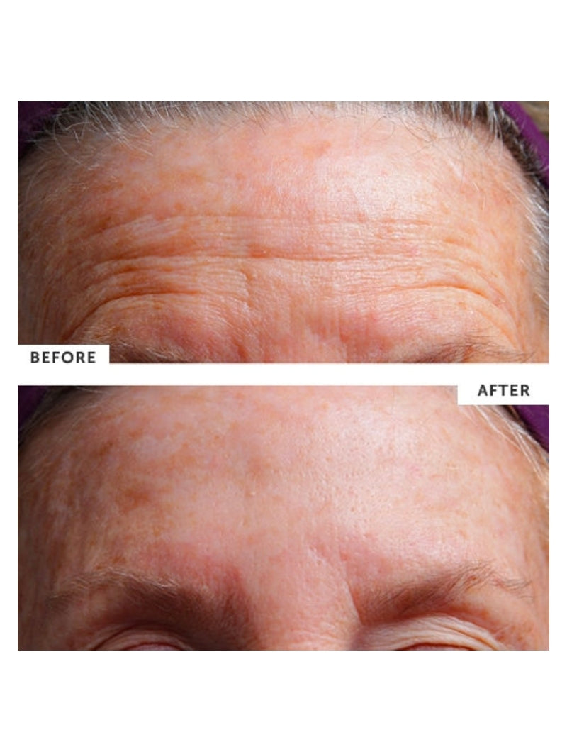 SilcSkin Facial Pad (Brow Set)