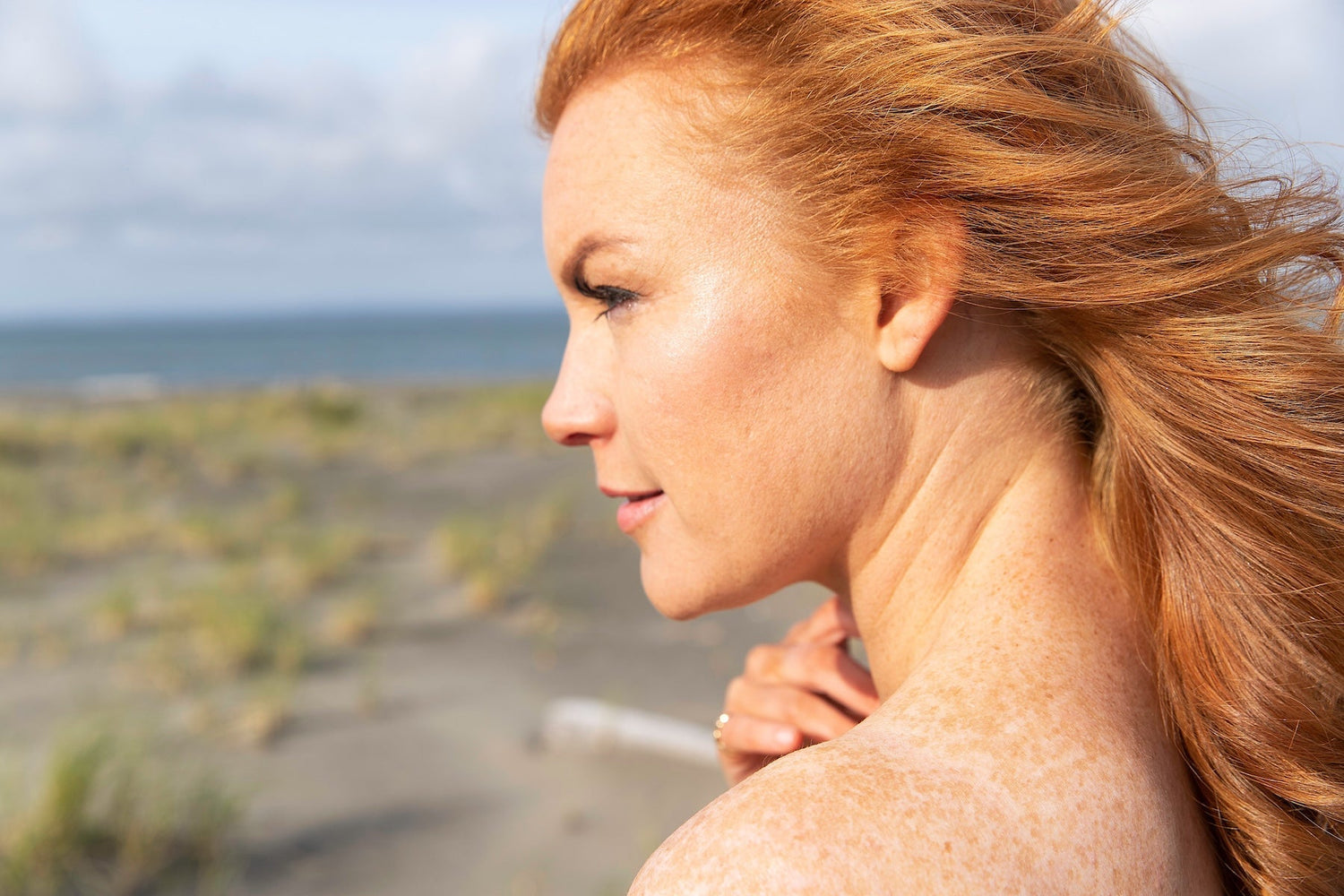 woman with sun damage